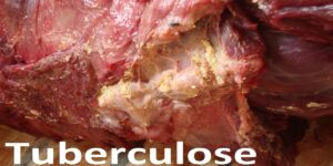 tuberculose.jpg